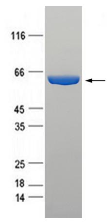 Purified recombinant Diphtheria toxin protein was analyzed by Tricine-SDS-PAGE 8 - 20% gel, run with Tris-Glycine running buffer